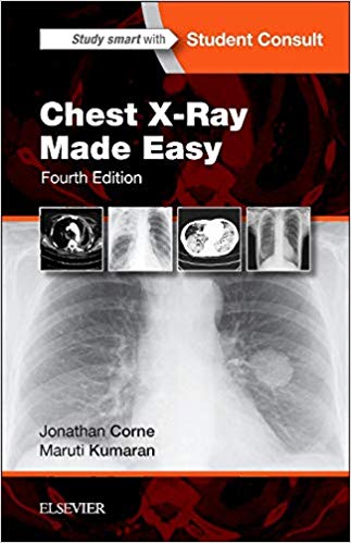 Chest X-Ray Made Easy (4th Edition)